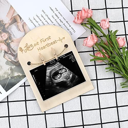 Поставка за ултразвукова рамка за обявяването на бременност Xunboo, Дървени Ултразвукова Картина, Подарък за Бъдещи майки, Детски душ,